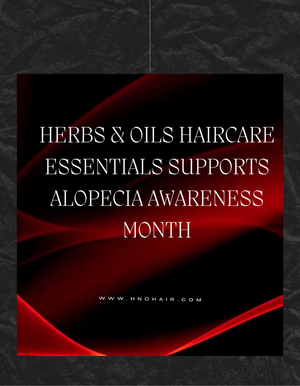 September is Alopecia Awareness Month - Focus on Traction Alopecia